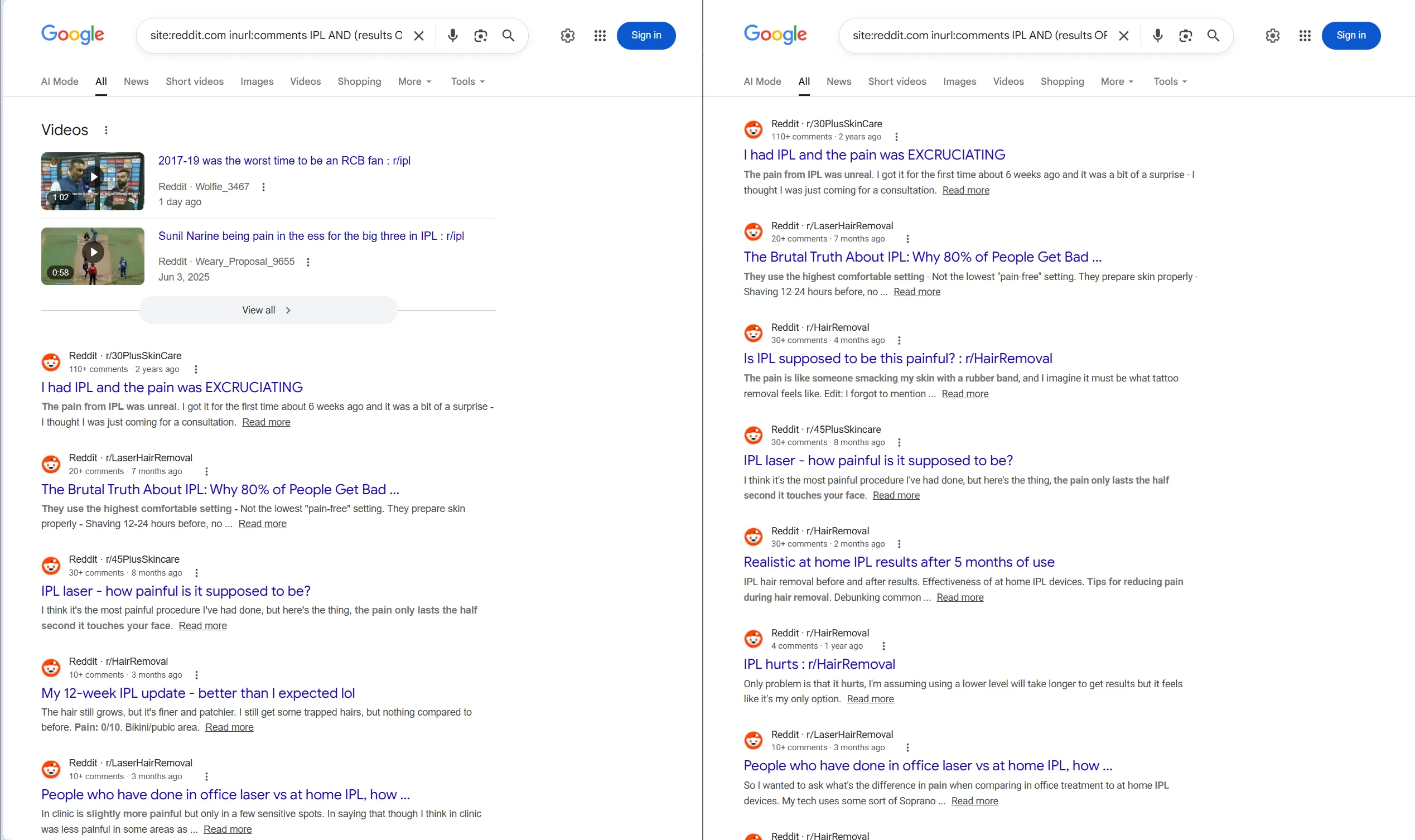 Two Google Search result pages for the same dork query returning IPL hair removal Reddit threads instead of the expected results